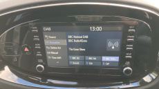 Toyota Aygo X 1.0 VVT-i Edge 5dr Auto Petrol Hatchback